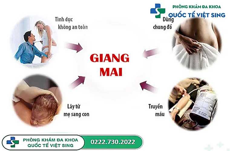 Giang mai và những con đường lây nhiễm phổ biến