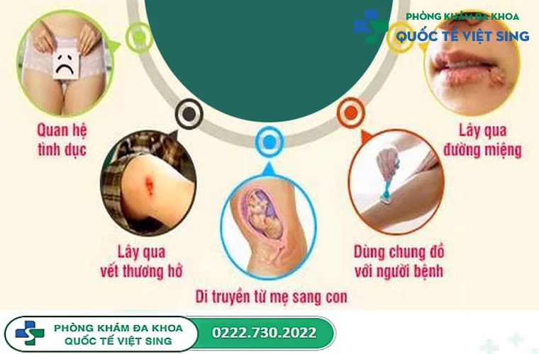 Nguyên nhân nhiễm bệnh mụn rộp sinh dục