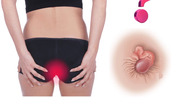 Điểm danh 10 địa chỉ phòng khám chữa lòi dom ở Bắc Ninh đáng tin cậy