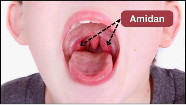Top 10 địa chỉ phòng khám cắt amidan Bắc Ninh uy tín, chi phí hợp lý 2025