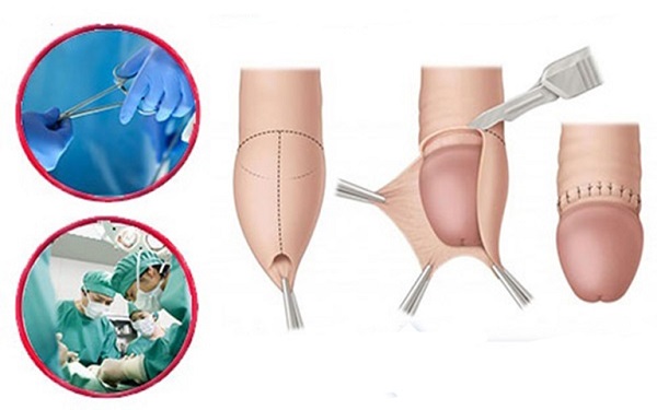 Top 10 địa chỉ phòng khám cắt bao quy đầu Bắc Giang uy tín, an toàn 2025