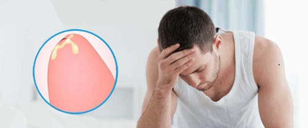 Top 10 địa chỉ phòng khám chữa dương vật chảy mủ hiệu quả, ít tái phát