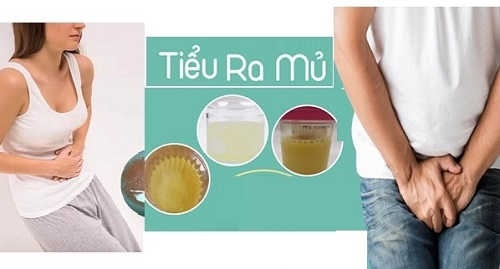 Top 10 địa chỉ phòng khám chữa tiểu buốt có mủ ở Bắc Ninh tốt nhất hiện nay