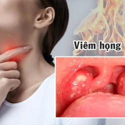 Top 10 địa chỉ phòng khám chữa viêm họng hạt ở Bắc Ninh tốt nhất 2025