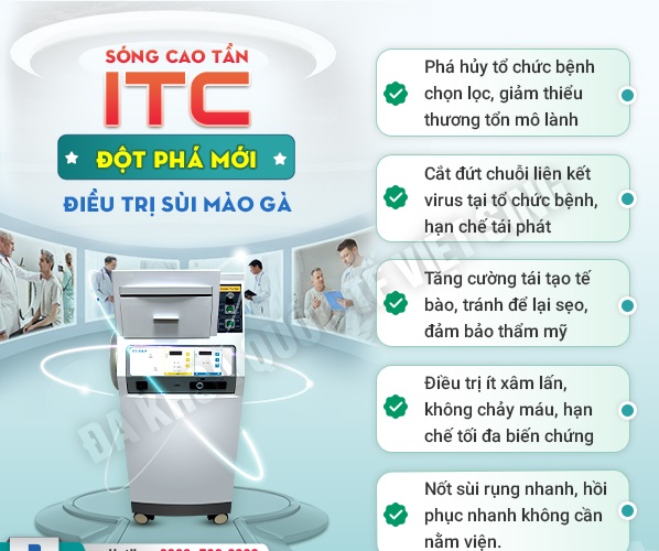 Sóng cao tần ITC – Phương pháp chữa sùi mào gà hiệu quả nhất hiện nay