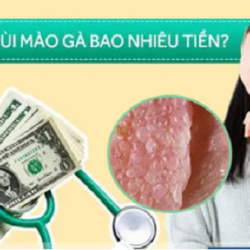 Đốt điện sùi mào gà bao nhiêu tiền? Bảng giá chi tiết 2025