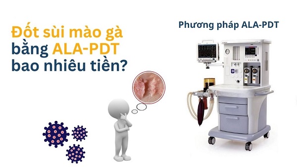 Công nghệ ALA-PDT bao nhiêu tiền? Có đắt không?