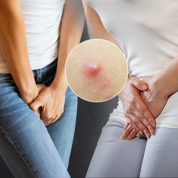 Chữa vùng kín mọc mụn Bắc Ninh ở đâu tốt? Gợi ý 10+ địa chỉ uy tín