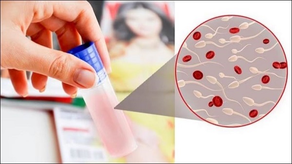 [TOP 10+] Địa chỉ chữa xuất tinh ra máu Bắc Ninh tốt nhất hiện nay