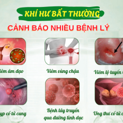 Khám khí hư bất thường Bắc Ninh: Địa chỉ uy tín chị em không nên bỏ lỡ