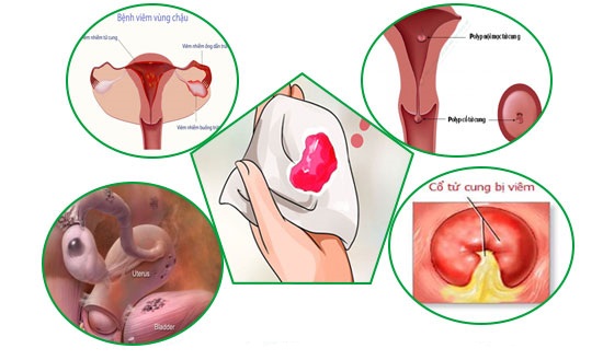 [Tổng hợp] Top 10 địa chỉ khám chữa chảy máu vùng kín Bắc Ninh hiệu quả nhất