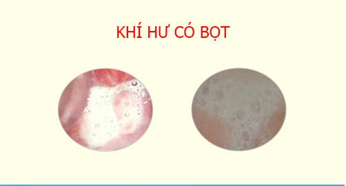 Chữa khí hư có bọt Bắc Ninh: Top 10 địa chỉ bác sĩ giỏi, chi phí minh bạch