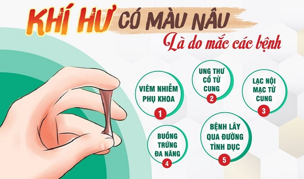 Khám khí hư màu nâu Bắc Ninh – Top 10 uy tín chị em tin chọn