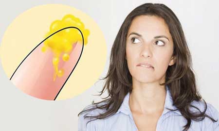 Địa chỉ khám khí hư màu vàng Bắc Ninh uy tín – Hơn 90% chị em phản hồi tốt