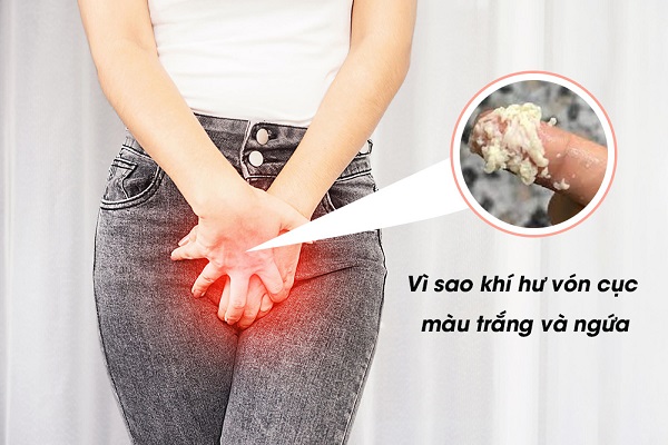 [Review] Top 10 địa chỉ khám khí hư vón cục Bắc Ninh hiệu quả, ít tái phát
