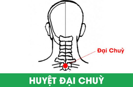 Huyệt Đại Chùy chữa đau cổ vai gáy: Bấm đúng 3 phút, cổ nhẹ hẳn