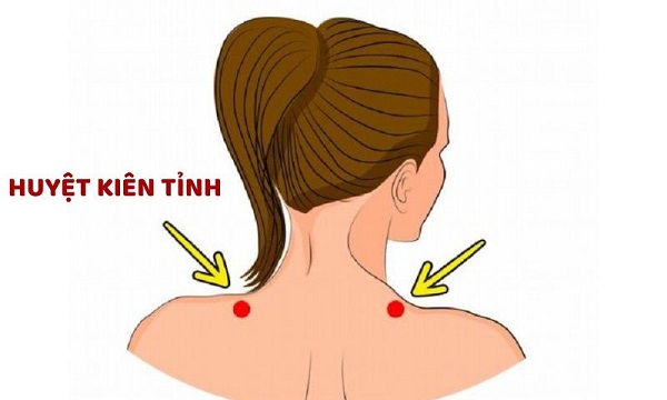 Huyệt Kiên Tỉnh trị vai gáy: Vị trí, cách bấm đúng giúp giảm đau nhanh