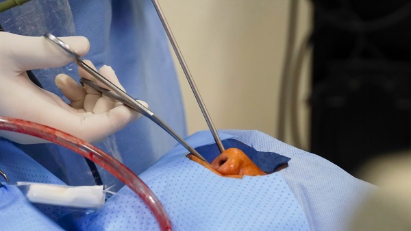 Mổ xoang mũi hết bao nhiêu tiền? Có được bảo hiểm hỗ trợ không?