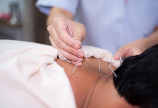 Lưu ý quan trọng khi sử dụng các huyệt châm cứu đau vai gáy bạn nên biết