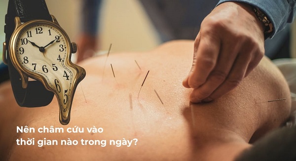 90% người chưa biết: Châm cứu vào thời gian nào trong ngày tốt nhất
