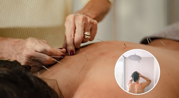 Châm cứu xong có tắm được không? Bao lâu thì tắm được?