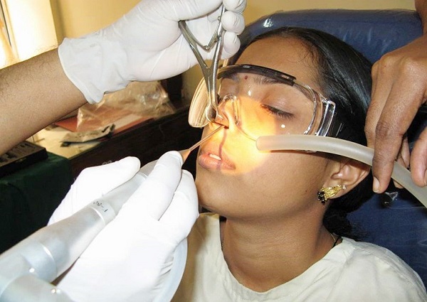 Mổ xoang có gây mê không hay chỉ gây tê? Sự thật nhiều người chưa biết