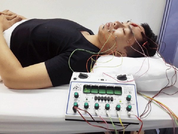 Nhược điểm của điện châm: 5 điều bạn nhất định phải biết trước khi điều trị